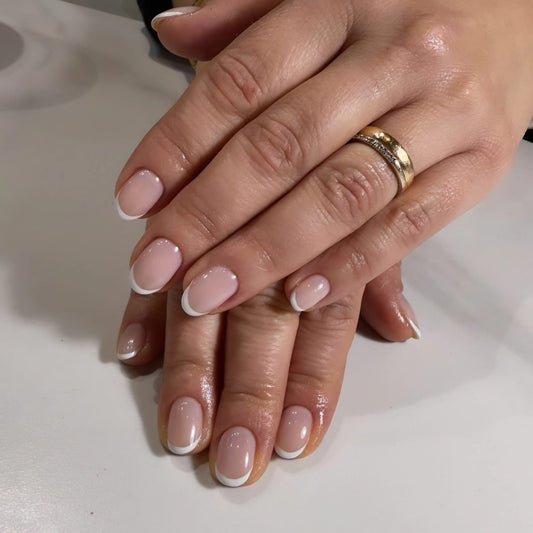 Gel overlay